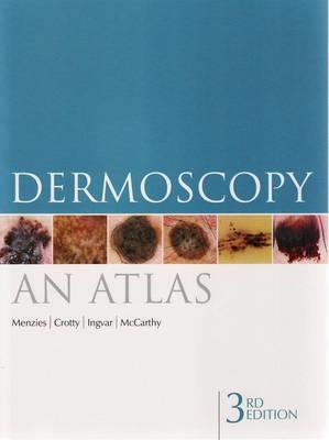 Dermoscopy: An Atlas - Click Image to Close