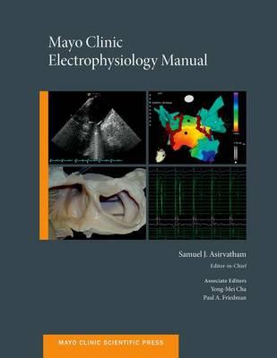 Mayo Clinic Electrophysiology Manual - Click Image to Close
