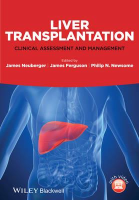 Liver Transplantation: Clinical Assessment and Management - Click Image to Close
