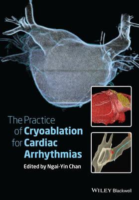 Practice of Catheter Cryoablation for Cardiac Arrhythmias, The - Click Image to Close