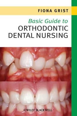 Basic Guide to Orthodontic Dental Nursing - Click Image to Close