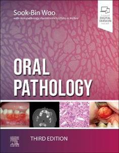 Oral Pathology 3E