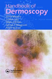 Handbook of Dermoscopy