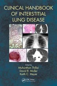 Clinical Handbook of Interstitial Lung Disease - Click Image to Close