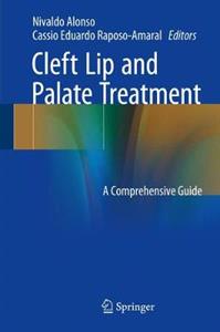 Cleft Lip and Palate Treatment: A Comprehensive Guide - Click Image to Close