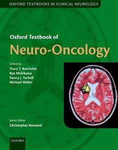 Oxford Textbook of Neuro-Oncology