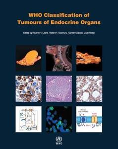 WHO classification of tumours of endocrine organs