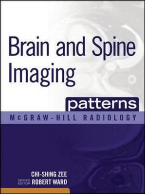 Brain and Spine Imaging Patterns - Click Image to Close