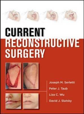 CURRENT Reconstructive Surgery - Click Image to Close