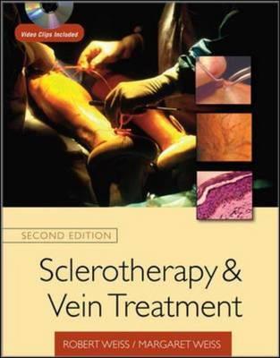 Sclerotherapy and Vein Treatment, Second Edition SET - Click Image to Close