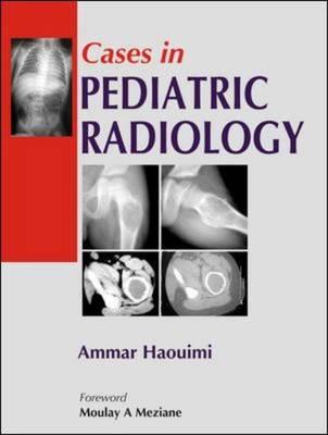 Cases in Pediatric Radiology - Click Image to Close