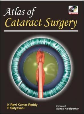 Atlas of Cataract Surgery - Click Image to Close