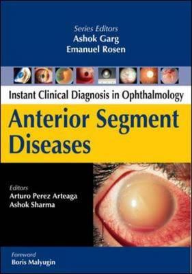 Anterior Segment Diseases - Click Image to Close