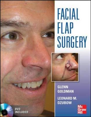 Facial Flaps Surgery - Click Image to Close