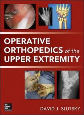 Operative Orthopedics of the Upper Extremity - Click Image to Close