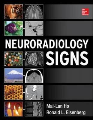 Neuroradiology Signs - Click Image to Close