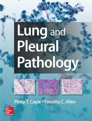 Lung and Pleural Pathology - Click Image to Close
