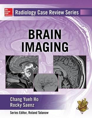 Radiology Case Review Series: Brain Imaging - Click Image to Close