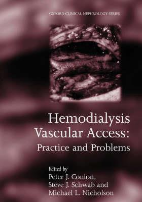 Hemodialysis Vascular Access - Click Image to Close