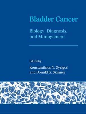 Bladder Cancer - Click Image to Close