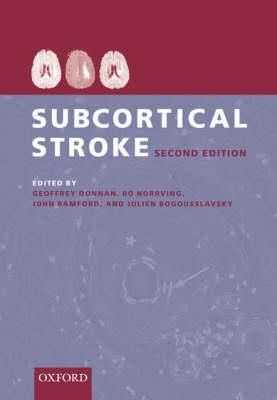 Subcortical Stroke - Click Image to Close