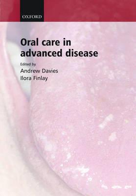 Oral Care in Advanced Disease - Click Image to Close