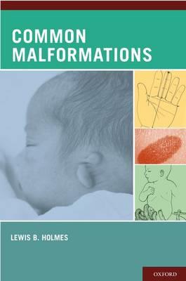 Common Malformations - Click Image to Close