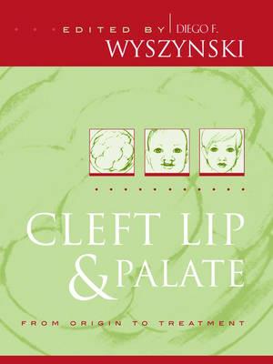 Cleft Lip and Palate - Click Image to Close