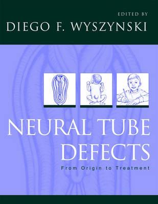 Neural Tube Defects - Click Image to Close