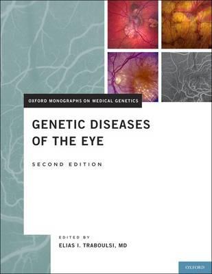 Genetic Diseases of the Eye - Click Image to Close