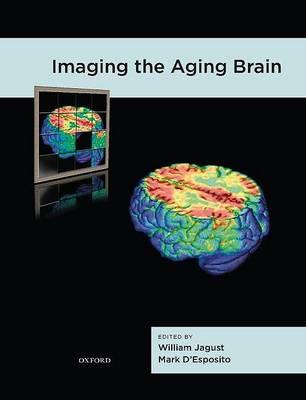 Imaging the Aging Brain - Click Image to Close