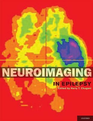 Neuroimaging in Epilepsy - Click Image to Close