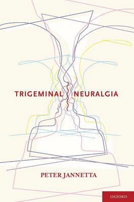 Trigeminal Neuralgia - Click Image to Close