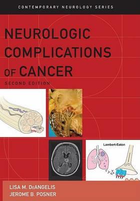 Neurologic Complications of Cancer - Click Image to Close