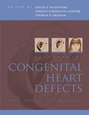 Congenital Heart Defects - Click Image to Close