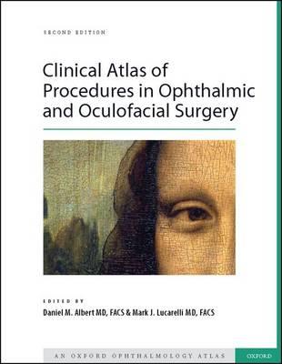 Clinical Atlas of Procedures in Ophthalmic and Oculofacial Surgery - Click Image to Close