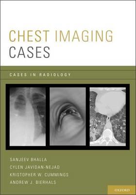 Chest Imaging Cases - Click Image to Close