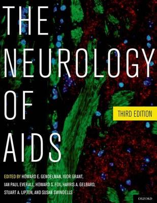 The Neurology of AIDS - Click Image to Close