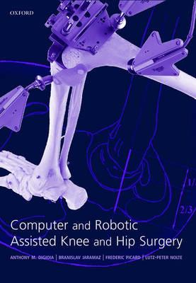 Computer and Robotic Assisted Hip and Knee Surgery - Click Image to Close