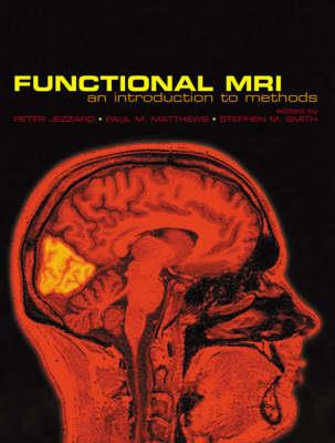 Functional Magnetic Resonance Imaging - Click Image to Close