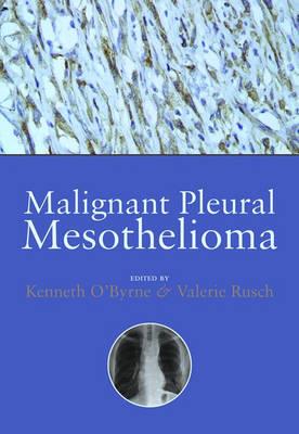 Malignant Pleural Mesothelioma - Click Image to Close