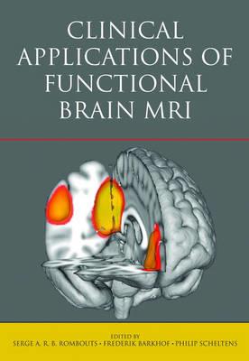 Clinical Applications of Functional Brain MRI - Click Image to Close