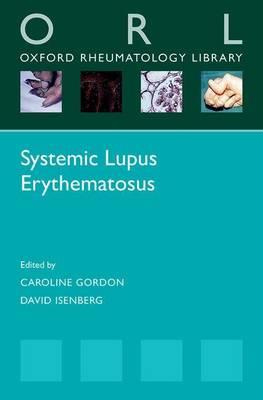 Systemic Lupus Erythematosus - Click Image to Close