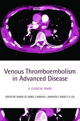 Venous Thromboembolism in Advanced Disease - Click Image to Close