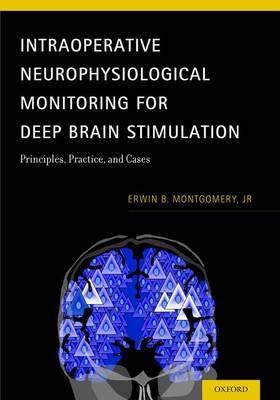 Intraoperative Neurophysiological Monitoring for Deep Brain Stimulation: Principles, Practice and Cases - Click Image to Close