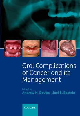 Oral Complications of Cancer and its Management - Click Image to Close