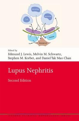 Lupus Nephritis - Click Image to Close