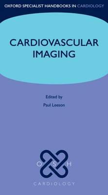 Cardiovascular Imaging - Click Image to Close