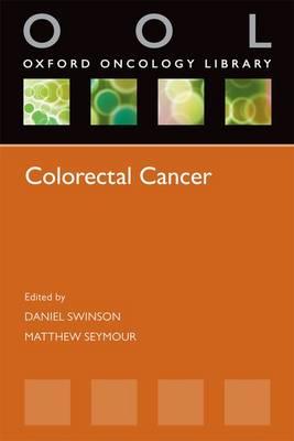 Colorectal Cancer - Click Image to Close