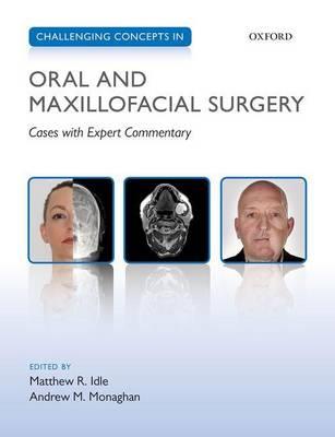 Challenging Concepts in Oral and Maxillofacial Surgery: Cases with Expert Commentary - Click Image to Close